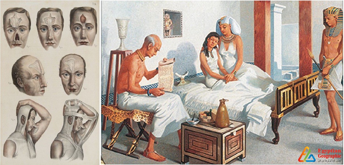 جراحات التجميل من مصر القديمة إلي بلاد الهند ورحلة البحث عن الكمال